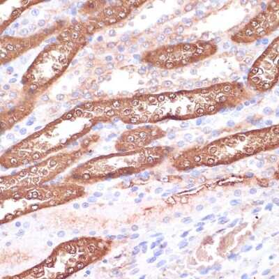 Immunohistochemistry-Paraffin: Gemin 5 Antibody [NBP3-15523] - Immunohistochemistry of paraffin-embedded rat kidney using Gemin 5 antibody (NBP3-15523) at dilution of 1:100 (40x lens).Perform microwave antigen retrieval with 10 mM PBS buffer pH 7.2 before commencing with IHC staining protocol.