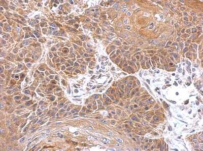 Immunohistochemistry-Paraffin: Gephyrin/GPHN Antibody [NBP2-16641] - Analysis of paraffin-embedded mouse brain, using antibody at 1:500 dilution.