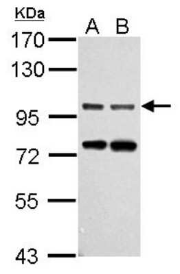 Western Blot: Gephyrin/GPHN Antibody [NBP2-16641] - Sample (30 ug of whole cell lysate) A: NIH-3T3 B: JC 7. 5% SDS PAGE gel, diluted at 1:1000.