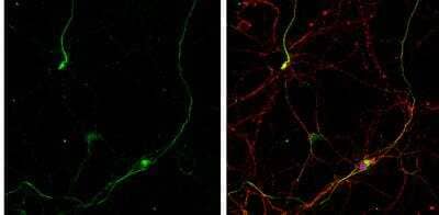 Immunocytochemistry/Immunofluorescence: Gephyrin/GPHN Antibody [NBP2-16641] -  DIV10 rat E18 primary hippocampal neurons were fixed in 4% paraformaldehyde at RT for 15 min. Green: Gephyrin protein stained by Gephyrin antibody [N2C1], Internal  diluted at 1:500. Red: beta Tubulin 3/ Tuj1, stained by beta Tubulin 3/ Tuj1 antibody [1338] diluted at 1:500. Blue: Fluoroshield with DAPI. 