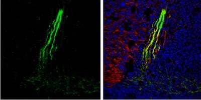 Immunohistochemistry-Frozen: Gephyrin/GPHN Antibody [NBP2-16641] - Frozen sectioned E13.5 Rat brain.  Green: Gephyrin protein stained by Gephyrin antibody [N2C1], Internal diluted at 1:250. Red: beta Tubulin 3/ TUJ1, a mature neuron marker, stained by beta Tubulin 3/ TUJ1 antibody [11710] diluted at 1:500.Blue: Fluoroshield with DAPI.  