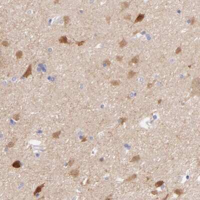 Immunohistochemistry-Paraffin: Gephyrin/GPHN Antibody [NBP1-87875] - Staining of human lateral ventricle shows moderate cytoplasmic positivity in neuronal cells.