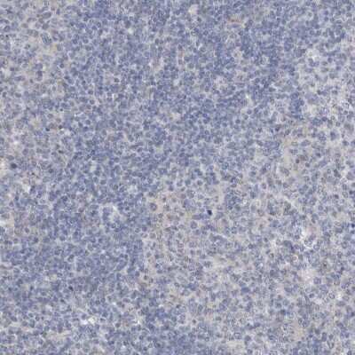 Immunohistochemistry-Paraffin: Gephyrin/GPHN Antibody [NBP1-87876] - Staining of human lymph node shows low expression as expected.