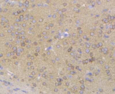 Immunohistochemistry-Paraffin: Gephyrin/GPHN Antibody (JG34-47) [NBP2-75504] - Analysis of paraffin-embedded mouse brain tissue using anti-Gephyrin antibody. Counter stained with hematoxylin. The section was pre-treated using heat mediated antigen retrieval with sodium citrate buffer (pH6) for 20 mins.