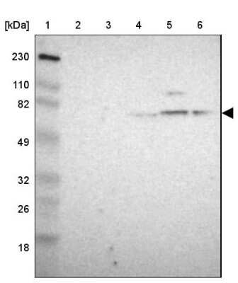 Western Blot: Gephyrin/GPHN Antibody [NBP1-87875] - Lane 1: Marker  [kDa] 230, 110, 82, 49, 32, 26, 18.   Lane 2: Human cell line RT-4.  Lane 3: Human cell line U-251MG sp.  Lane 4: Human plasma (IgG/HSA depleted).  Lane 5: Human liver tissue.  Lane 6: Human tonsil tissue