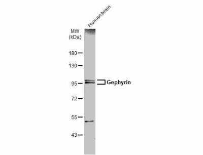 Western Blot: Gephyrin/GPHN Antibody [NBP2-16641] - Human tissue extract (30 ug) was separated by 7.5% SDS-PAGE, and the membrane was blotted with Gephyrin antibody [N2C1], Internal diluted at 1:2000. The HRP-conjugated anti-rabbit IgG antibody (NBP2-19301) was used to detect the primary antibody.