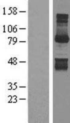 Western Blot: Gephyrin Overexpression Lysate (Adult Normal) [NBL1-11229] Left-Empty vector transfected control cell lysate (HEK293 cell lysate); Right -Over-expression Lysate for Gephyrin.