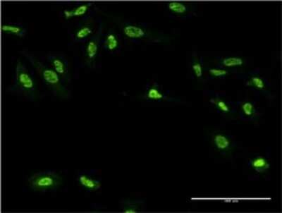 Immunocytochemistry/Immunofluorescence: Gigaxonin Antibody (4G7) [H00008139-M01] - Analysis of monoclonal antibody to GAN on HeLa cell . Antibody concentration 10 ug/ml.