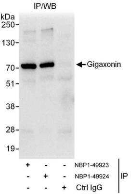 Immunoprecipitation: Gigaxonin Antibody [NBP1-49923] - Samples: Whole cell lysate (1 mg for IP, 20% of IP loaded) from HeLa cells. Antibodies: Affinity purified rabbit anti-Gigaxonin antibody NBP1-49923 used for IP at 3 ug/mg lysate. Gigaxonin was also immunoprecipitated by rabbit anti-Gigaxonin antibody NBP1-49924, which recognizes a downstream epitope. For blotting immunoprecipitated Gigaxonin, NBP1-49924 was used at 1ug/ml. Detection: Chemiluminescence with an exposure time of 10 seconds.