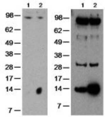 Western Blot: GilZ Antibody (CFMKG15) [NBP2-00143] - Left: Mouse thymocytes cultured without (lane 1) or with (lane 2) dexamethasone (10e-7 M) for 3 hr. The membrane was probed with 10 ug/mL of Anti-Human/Mouse GILZ Purified, followed by Anti-Rat IgG HRP. Right: Normal human peripheral blood cells cultured without (lane 1) or with (lane 2) dexamethasone (10e-7 M) for 3 hours. The membrane was probed with 2 ug/mL of Anti-Human/Mouse GILZ Purified, followed by Anti-Rat IgG HRP.