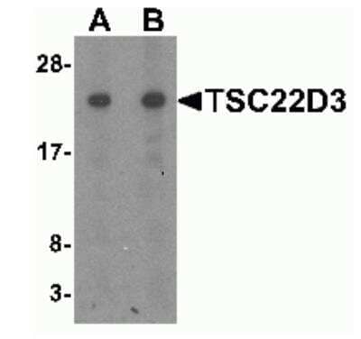 Western Blot: GilZ Antibody [NBP2-41210] - Analysis of TSC22D3 in human small intestine tissue lysate with TSC22D3 antibody at (A) 1 and (B) 2 ug/mL.