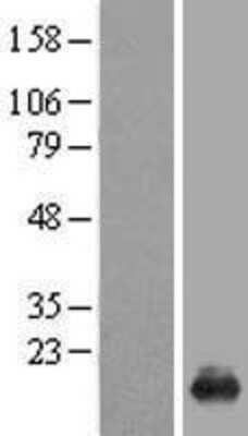 Western Blot: GilZ Overexpression Lysate (Adult Normal) [NBL1-17352] Left-Empty vector transfected control cell lysate (HEK293 cell lysate); Right -Over-expression Lysate for GilZ.