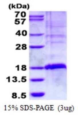 SDS-Page: GilZ Protein [NBP2-22895]