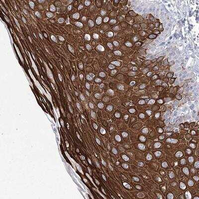 Immunohistochemistry: Girdin Antibody [NBP1-90135] - Staining of human esophagus shows strong cytoplasmic positivity in squamous epithelial cells.
