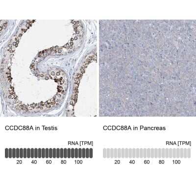 <b>Orthogonal Strategies Validation. </b>Immunohistochemistry-Paraffin: Girdin Antibody [NBP2-38387] - Staining in human testis and pancreas tissues using anti-CCDC88A antibody. Corresponding CCDC88A RNA-seq data are presented for the same tissues.