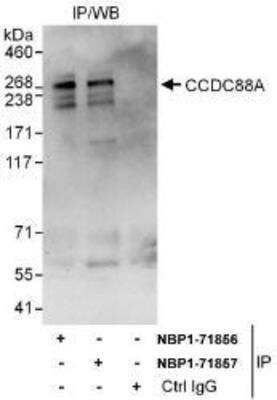 Immunoprecipitation: Girdin Antibody [NBP1-71856] - Whole cell lysate (1 mg for IP, 20% of IP loaded) from HeLa cells. Affinity purified rabbit anti-CCDC88A antibody used for IP at 6 mcg/mg lysate.  CCDC88A was also immunoprecipitated by rabbit anti-CCDC88A antibody NBP1-71857 , which recognizes a downstream epitope. For blotting immunoprecipitated CCDC88A, NBP1-71857 was used at 1 ug/ml.