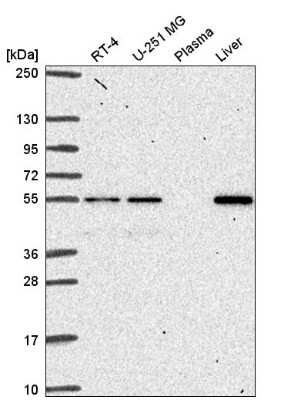 Western Blot: GliS2 Antibody [NBP2-54964] - Western blot analysis in human cell line RT-4, human cell line U-251 MG, human plasma and human liver tissue.