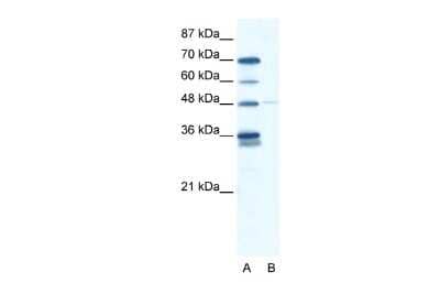 Western Blot: GliS2 Antibody [NBP2-84978] - WB Suggested Anti-GLIS2 Antibody Titration: 2.5ug/ml. ELISA Titer: 1:12500. Positive Control: HepG2 cell lysate