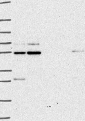 Western Blot: GliS2 Antibody [NBP3-17373] - Lane 1: Marker [kDa] 250, 130, 95, 72, 55, 36, 28, 17, 10;   Lane 2: RT4;   Lane 3: U-251 MG;   Lane 4: Human Plasma;   Lane 5: Liver;   Lane 6: Tonsil