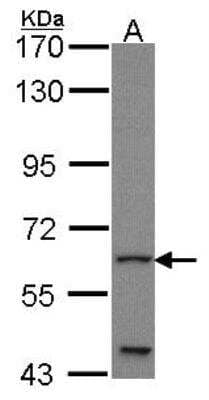 Western Blot: Glis1 Antibody [NBP1-31273] -  Sample (30 ug of whole cell lysate) A: JurKat 7.5% SDS PAGE; antibody diluted at 1:1000.