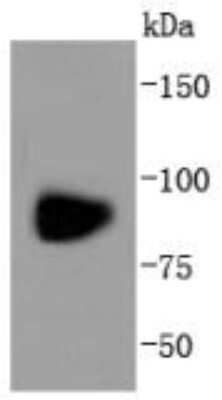 Western Blot: GluR1 Antibody (SD2010) [NBP2-67737] - Analysis of GluR1 on rat brain lysates using anti-GluR1 antibody at 1/1,000 dilution.