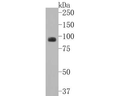 Western Blot: GluR1 Antibody (SD2010) [NBP2-67737] - Western blot analysis of GluR1 on mouse hippocampus tissue lysates. Proteins were transferred to a PVDF membrane and blocked with 5% BSA in PBS for 1 hour at room temperature. The primary antibody (1/500) was used in 5% BSA at room temperature for 2 hours
