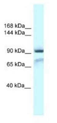 Western Blot: GluR1 Antibody [NBP1-82396] - Mouse Pancreas Lysate 1ug/ml Gel Concentration 6-18%