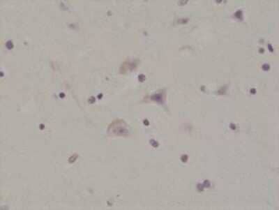 Immunohistochemistry-Paraffin: GluR1 [p Ser845] Antibody (RM296) [NBP2-61472] - Immunohistochemical staining of formalin fixed and paraffin embedded human brain tissue section using NBP2-61472 at a 1:200 dilution.