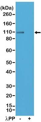 Western Blot GluR1 [p Ser845] Antibody (RM296)