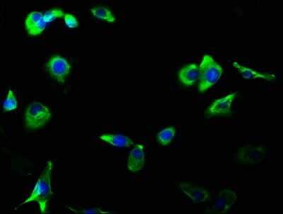 Immunocytochemistry/Immunofluorescence: GluR2/3 Antibody (4C3) [NBP3-15223] - Immunofluorescence staining of MCF-7 cells with GluR2/3 antibody at 1:56, counter-stained with DAPI. The cells were fixed in 4% formaldehyde, permeabilized using 0.2% Triton X-100 and blocked in 10% normal Goat Serum. The cells were then incubated with the antibody overnight at 4C. The secondary antibody was Alexa Fluor 488-congugated Goat Anti-Rabbit IgG (H+L).