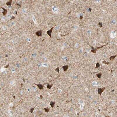 Immunohistochemistry: GluR2 Antibody [NBP1-89765] - Staining of human cerebral cortex shows strong cytoplasmic positivity in neuronal cells.