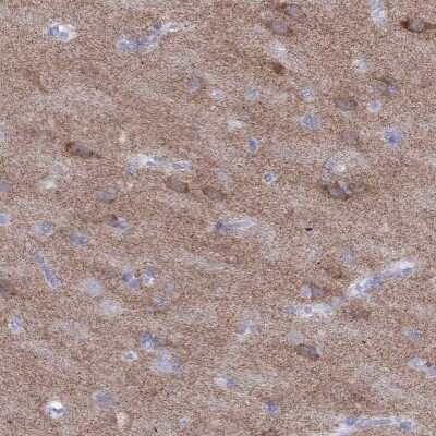 Immunohistochemistry-Paraffin: GluR2 Antibody [NBP1-89765] - Staining of human cerebral cortex shows high expression.