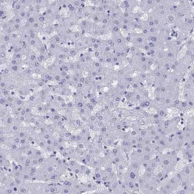 Immunohistochemistry-Paraffin: GluR2 Antibody [NBP1-89765] - Staining of human liver shows no positivity in hepatocytes as expected.