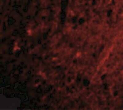 Immunocytochemistry/Immunofluorescence: GluR5/GRIK1 Antibody [NBP1-76850] - Immunofluorescence of Grik1 in Human Brain cells with Grik1 antibody at 20 ug/mL.