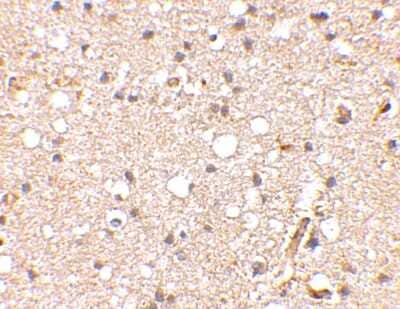 Immunohistochemistry-Paraffin: GluR5/GRIK1 Antibody [NBP1-76850] - Human brain tissue using Glutamate receptor 5 antibody at 2.5 ug/ml.