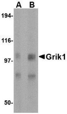 Western Blot: GluR5/GRIK1 Antibody [NBP1-76850] - Rt brain tissue lysate with Glutamate receptor 5 antibody at (A) 0.5 and (B) 1 ug/ml.