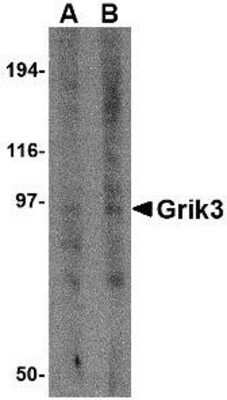 Western Blot: GluR7/GRIK3 Antibody [NBP1-76387] - Human brain tissue lysate with Glutamate receptor 7 antibody at (A) 1 and (B) 2 ug/ml.