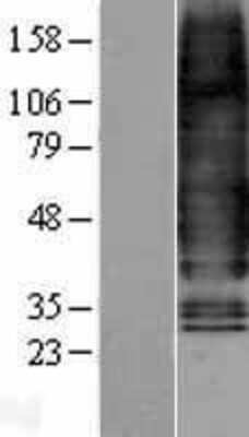 Western Blot Glucagon R/GCGR Overexpression Lysate