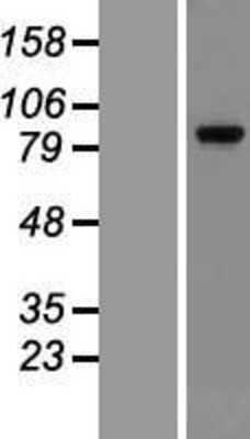 Western Blot: Glucocorticoid Receptor Overexpression Lysate (Adult Normal) [NBP2-11020] Left-Empty vector transfected control cell lysate (HEK293 cell lysate); Right -Over-expression Lysate for Glucocorticoid Receptor.