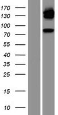 Western Blot: Glucocorticoid Receptor Overexpression Lysate (Adult Normal) [NBP2-11025] Left-Empty vector transfected control cell lysate (HEK293 cell lysate); Right -Over-expression Lysate for Glucocorticoid Receptor.