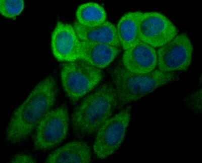 Immunocytochemistry/Immunofluorescence: Glucocorticoid Receptor alpha Antibody (3F1) [NBP2-75508] - Staining Glucocorticoid Receptor alpha (green) in SiHa cells. The nuclear counter stain is DAPI (blue). Cells were fixed in paraformaldehyde, permeabilised with 0.25% Triton X100/PBS.