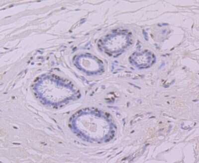 Immunohistochemistry-Paraffin: Glucocorticoid Receptor alpha Antibody (3F1) [NBP2-75508] - Analysis of paraffin-embedded human spleen tissue using anti-Glucocorticoid Receptor alpha antibody. Counter stained with hematoxylin.