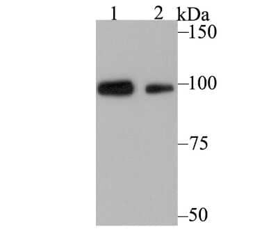 Western Blot: Glucocorticoid Receptor alpha Antibody (3F1) [NBP2-75508] - Analysis of Glucocorticoid Receptor alpha on SiHa (1) and A549 (2) cell lysates using anti-Glucocorticoid Receptor alpha antibody at 1/5,000 dilution.