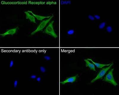 Immunocytochemistry/Immunofluorescence: Glucocorticoid Receptor alpha Antibody (3F2) [NBP2-75509] - Analysis of Hela cells labeling Glucocorticoid Receptor alpha with Mouse anti-Glucocorticoid Receptor alpha antibody at 1/50 dilution. Cells were fixed in 4% paraformaldehyde for 30 minutes, permeabilized with 0.1% Triton X-100 in PBS for 15 minutes, and then blocked with 2% BSA for 30 minutes at room temperature. Cells were then incubated with Mouse anti-Glucocorticoid Receptor alpha antibody at 1/50 dilution in 2% BSA overnight at 4 . Goat Anti-Mouse IgG H&L (iFluor(TM) 488) was used as the secondary antibody at 1/1,000 dilution. PBS instead of the primary antibody was used as the secondary antibody only control. Nuclear DNA was labelled in blue with DAPI.
