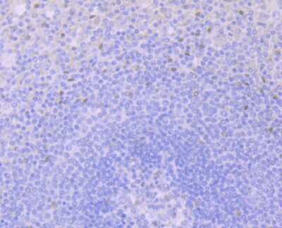 Immunohistochemistry-Paraffin: Glucocorticoid Receptor alpha Antibody (3F2) [NBP2-75509] - Analysis of paraffin-embedded human spleen tissue using anti-Glucocorticoid Receptor alpha antibody. Counter stained with hematoxylin.