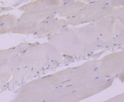 Immunohistochemistry-Paraffin: Glucocorticoid Receptor alpha Antibody (3F2) [NBP2-75509] - Analysis of paraffin-embedded mouse smooth muscle tissue using anti-Glucocorticoid Receptor alpha antibody. Counter stained with hematoxylin.