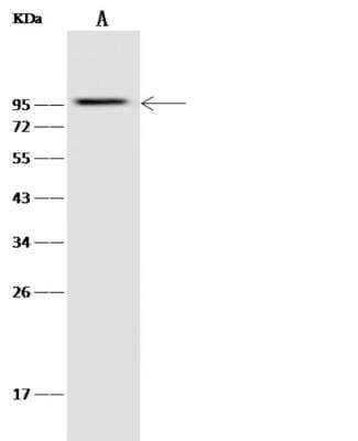 Western Blot: Glucokinase/GCK Antibody (223) [NBP2-89787] - Lane A: HepG2 Whole Cell Lysate Lysates/proteins at 30 ug per lane.Secondary Goat Anti-Rabbit IgG (H+L)/HRP at 1/10000 dilution.Developed using the ECL technique. Performed under reducing conditions.Predicted band size:92 kDa Observed band size:95 kDa