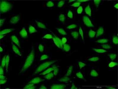 Immunocytochemistry/Immunofluorescence: Glucokinase/GCK Antibody [H00002645-D01P] - Analysis of antibody to GCK on HeLa cell. Antibody concentration 10 ug/ml.