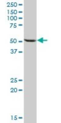 Western Blot: Glucokinase/GCK Antibody [H00002645-B01P] - Analysis of GCK expression in human liver.