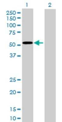 Western Blot: Glucokinase/GCK Antibody [H00002645-B01P] - Analysis of GCK expression in transfected 293T cell line by GCK polyclonal antibody.  Lane 1: GCK transfected lysate(51.15 KDa). Lane 2: Non-transfected lysate.